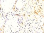 TGM4 Antibody in Immunohistochemistry (IHC)