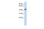 RDH16 Polyclonal Antibody