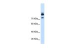 MTMR1 Polyclonal Antibody