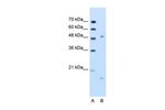 ITGBL1 Polyclonal Antibody