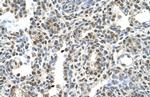 MAGEA8 Polyclonal Antibody