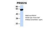 PRSS16 Antibody in Western Blot (WB)