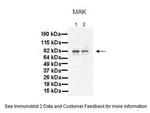 MAK Antibody in Western Blot (WB)