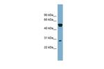 SLA Polyclonal Antibody