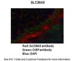 SLC38A3 Polyclonal Antibody