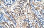 PSG1 Polyclonal Antibody