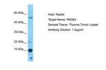 PAGE4 Polyclonal Antibody