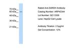 SARDH Antibody in Western Blot (WB)