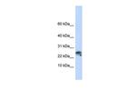 Granulysin Polyclonal Antibody