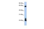RhoD Antibody in Western Blot (WB)