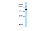 GAPVD1 Antibody in Western Blot (WB)