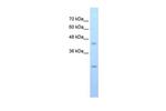 SLC48A1 Antibody in Western Blot (WB)