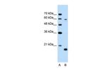 SLC38A4 Polyclonal Antibody