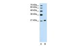 Ankyrin 1 Antibody in Western Blot (WB)