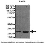RAB38 Polyclonal Antibody