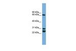 DNAI2 Polyclonal Antibody