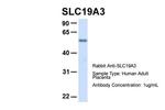 SLC19A3 Polyclonal Antibody