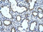 GNAS Polyclonal Antibody