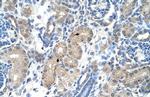 FOXR2 Polyclonal Antibody