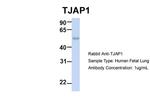 TJAP1 Antibody in Western Blot (WB)