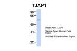 TJAP1 Antibody in Western Blot (WB)