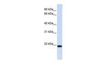 TJAP1 Polyclonal Antibody