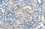 FKBP6 Polyclonal Antibody