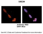 UBE2M Polyclonal Antibody