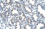 ALY Polyclonal Antibody