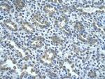 AIP2 Polyclonal Antibody