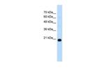FBXO25 Antibody in Western Blot (WB)