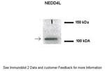 NEDD4L Polyclonal Antibody