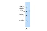 RNF38 Polyclonal Antibody