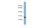 TMEM176A Polyclonal Antibody