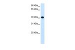 ADH4 Antibody in Western Blot (WB)