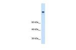 MTTP Polyclonal Antibody