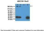 ABCC9 Polyclonal Antibody