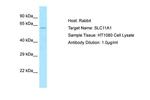 SLC11A1 Polyclonal Antibody