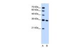 SLC25A29 Polyclonal Antibody