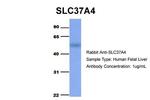 SLC37A4 Antibody in Western Blot (WB)