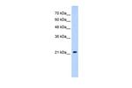 SLC25A14 Polyclonal Antibody