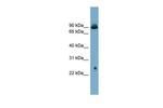 GlyT2 Polyclonal Antibody