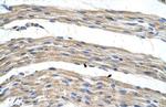 SLC17A4 Polyclonal Antibody