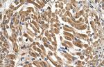 SLC17A5 Polyclonal Antibody