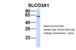 SLCO3A1 Antibody in Western Blot (WB)