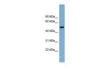 SLC2A8 Polyclonal Antibody