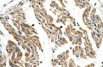 SLC35F2 Polyclonal Antibody