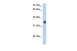 SLC35F2 Antibody in Western Blot (WB)