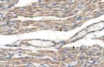 SLC2A6 Antibody in Immunohistochemistry (IHC)