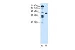 SLC35C1 Polyclonal Antibody